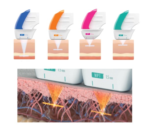 Classys Ultraformer MPT